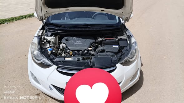 هيونداي النترا 2011 - صورة 1